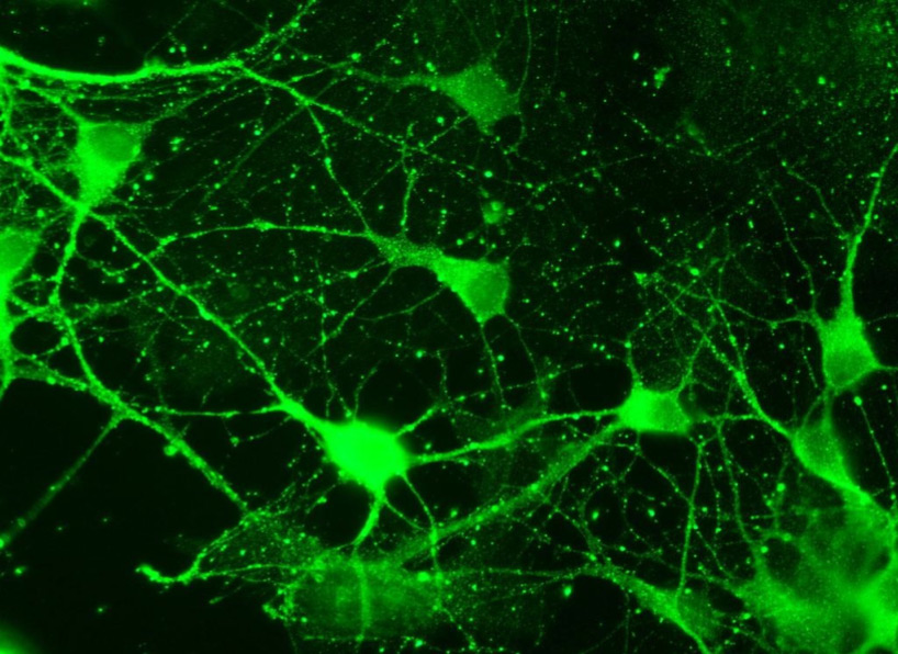neuroni-al-confocale