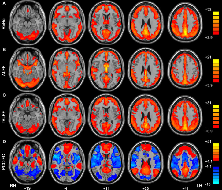 resting-fmri